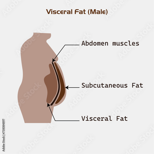 Location of Visceral fat stored within the abdominal cavity, Visceral fat and subcutaneous fat that accumulate around your waistline, man, women Illustration about medical diagram.obesity side view.