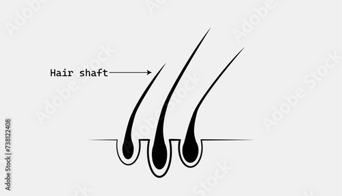 hair icon,Hair roots, 3, three, black,Head skin, hair vector illustration icon isolated human removal grow medical bulb, inforgraphic,Hair care , prevent split ends,Hair follicle treatment,Professiona