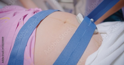 Pregnant woman lying in a hospital bed, fetal monitor strapped to her belly, Pregnant woman in labor with fetal heart rate monitor in hospital, healthcare during pregnancy photo