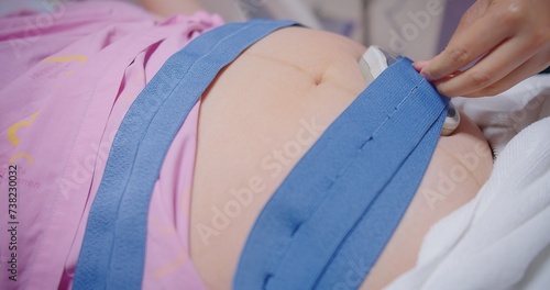 Vászonkép Pregnant woman lying in a hospital bed, fetal monitor strapped to her belly, Pre