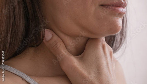 Obraz na płótnie Cervical lymphadenitis of the right side in a woman. w salonie