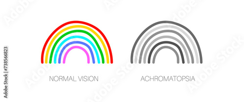 Achromatopsia vision deficiency