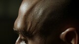 Image of a bald man’s head.