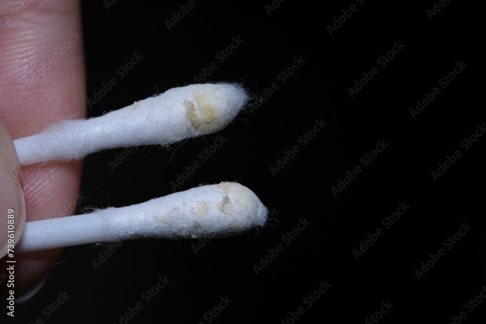 Obraz premium Macro shot of dry earwax on cotton buds