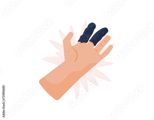 deep frostbite. illustration of a finger turning hard and black due to exposure to very cold temperatures. health problems. cartoon or flat illustration design. graphic elements. vector
