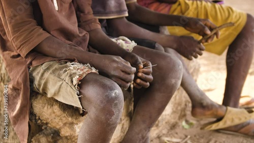 9 jan. 2024,Gwalada,Nigeria: Malnourished child due to extreme poverty, hunger, drought and climate change in Nigeria Africa . Rural African children Poor living conditions.poverty hunger in Africa photo