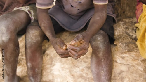 9 jan. 2024,Gwalada,Nigeria: Malnourished child due to extreme poverty, hunger, drought and climate change in Nigeria Africa . Rural African children Poor living conditions.poverty hunger in Africa photo
