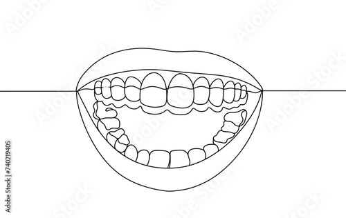 Mouth. Aligners. Teeth. Dentist