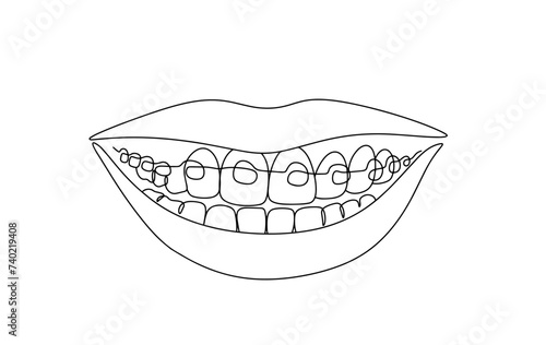 Mouth. Teeth. Braces. Dentistry