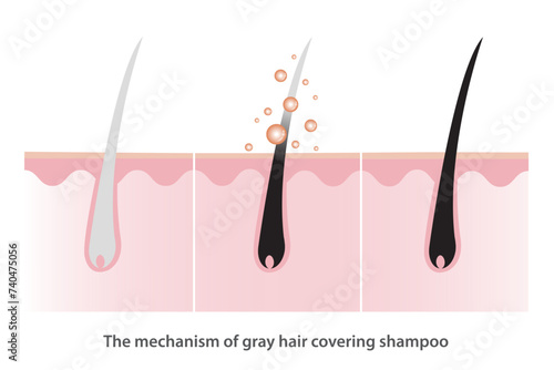 The mechanism of gray hair covering shampoo with scalp layer vector illustration isolated on white background. Herbal color serum, Coloring shampoo, hair care concept illustration.