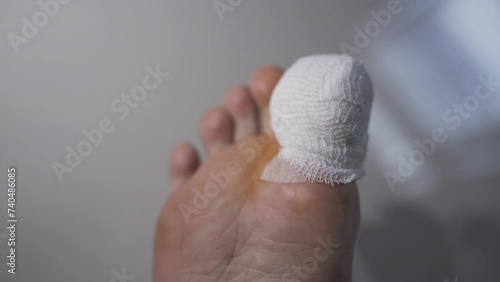 An injured toe with net bandage photo