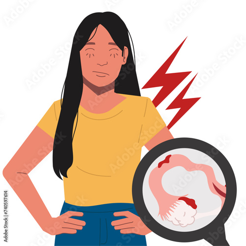 endometriosis female diseases suffer cramps in flat illustration