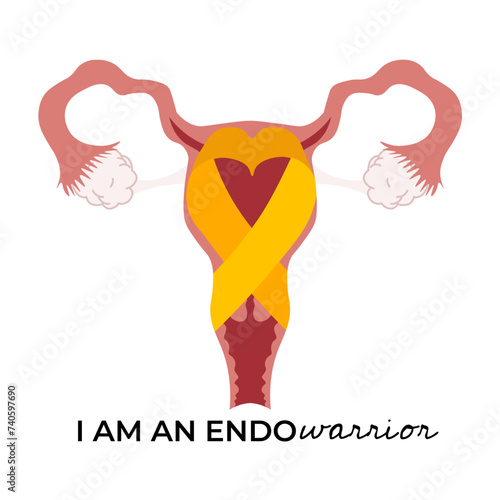 yellow ribbon in uterus for endometriosis awareness in flat illustration
