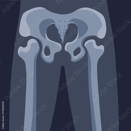 Human bones orthopedic and skeleton icon, bone x-ray image of human joints, anatomy skeleton flat design vector illustration