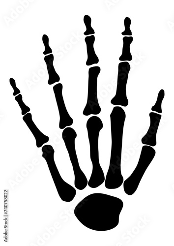 radiography of hand