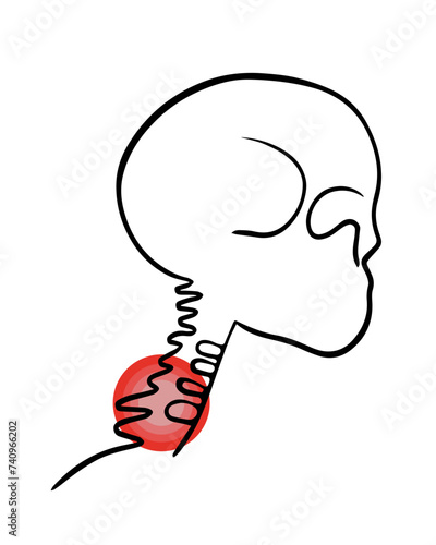 Vector isolated illustration of cervical vertebrae pain. Contour drawing of the cervical region with localization of pain in the vertebrae.