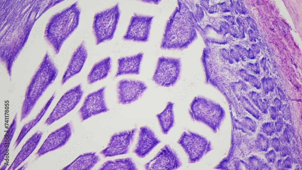 Colonic crypts in colon section. Microanatomy. Digestive system under ...
