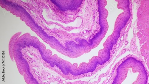Stratified squamous epithelium. 100x times magnification. Non-keratinized stratified epithelium, nucleuses, rest of the epithelial layer, underlying connective tissue and other epithelia photo
