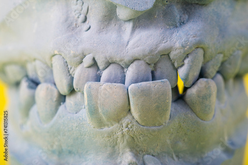 Blue plaster impression of the dental jaw of a patient with crooked teeth and malocclusions. Manufacturing of dentures and crowns based on orthodontic impressions, close-up photo