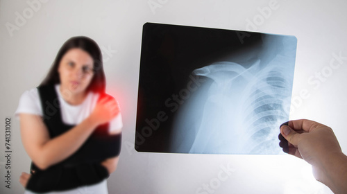 The doctor holds in his hand a medical x-ray of a dislocated humerus and a fractured collarbone against the background of a girl patient whose shoulder hurts. Fixing bandage for the shoulder joint.  photo