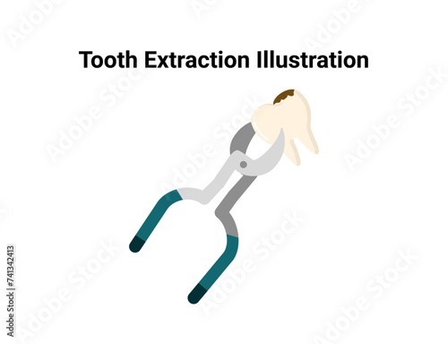 Tooth extraction illustration. Dentistry and orthodontics vector illustration. Dental clinic services, stomatology, dentistry, orthodontics, oral health care and hygiene vector.