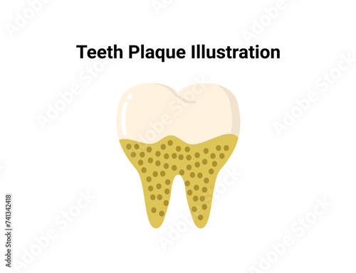 Teeth plaque illustration. Dentistry and orthodontics vector illustration. Dental clinic services, stomatology, dentistry, orthodontics, oral health care and hygiene vector.