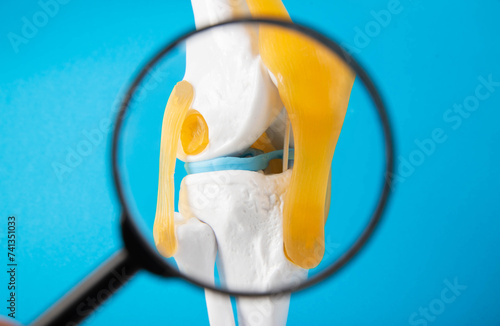 Medical mockup of a knee joint on a blue background under a magnifying glass. Knee joint problems concept. Bursitis, tendonitis and gout. Orthopedics, close-up photo