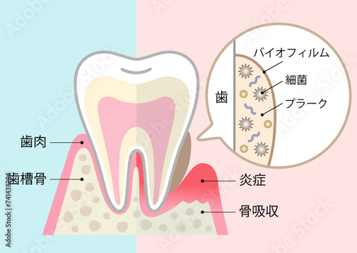 バイオフィルムと健康な歯
