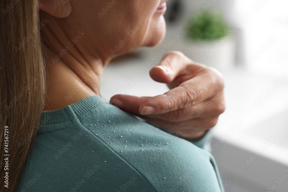 Woman brushing dandruff off her sweater indoors, closeup