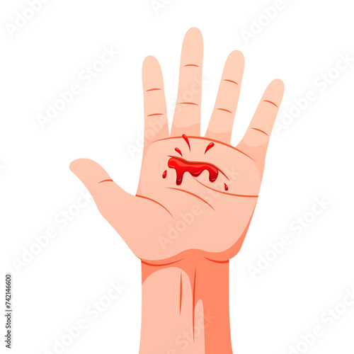 Hand with bleeding cut vector isolated on white background.