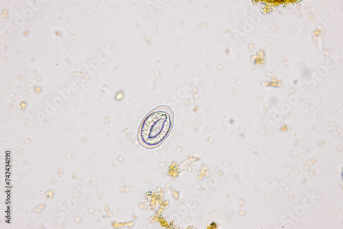 Finding Trichuris trichiura egg and Strongyloides egg in the feces under the microscope in Lab. photo