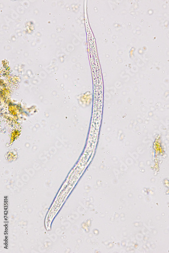 Finding Trichuris trichiura egg and Strongyloides egg in the feces under the microscope in Lab. photo