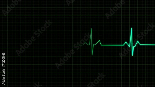 Heart rate monitor restart after failure with sound isolated with an alpha channel