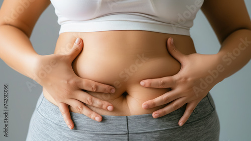 woman holds her belly with her hands, fat girl, plus size model, diet, weight loss, excess weight, skin folds, body, beauty, curvy, big, sports, fitness, obese