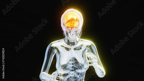 Abstract illustration of woman suffering from headache