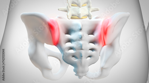 Inflammation of sacroiliac joints, called Sacroiliitis, causing pain in the lower back. 3d illustration on white background photo