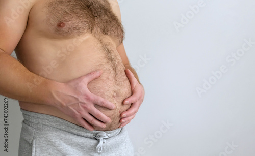 Man with bare fat big belly shakes fat folds on his stomach, obesity, health, beer belly. Problem area of body. Hormones. Overweight. Obesity. Copy space photo