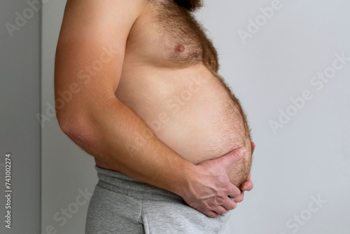 Schilderij op canvas Man with bare fat big belly shakes fat folds on his stomach, obesity, health, beer belly