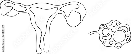 Uterus. Ovarian cyst. Follicular ovary. Gynecology