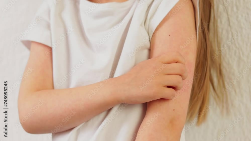 A red rash on the arm of an itchy child, measles, rubella, enteroviruses A red rash on the arm of an itchy child, measles, rubella, enteroviruses
