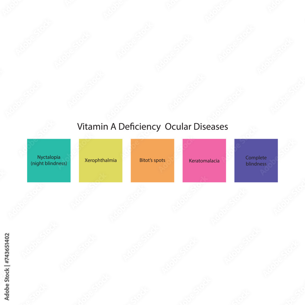 Diagram showing Vitamin A deficiency related ocular diseases