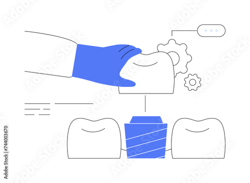 Artificial tooth placement abstract concept vector illustration.