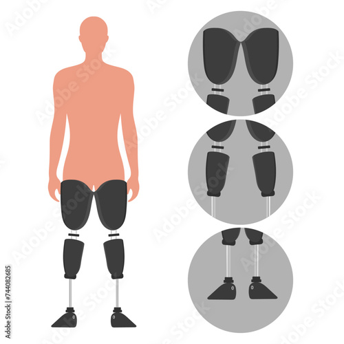 Legs Prosthetic Limb Man Prosthesis