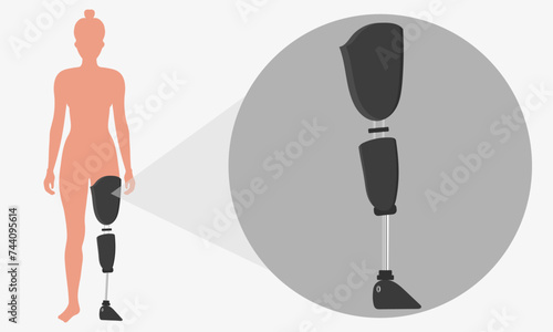Legs Prosthetic Limb woman Prosthesis, artificial leg zoom
