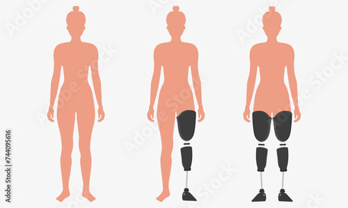 Legs Prosthetic Limb woman Prosthesis, artificial legs