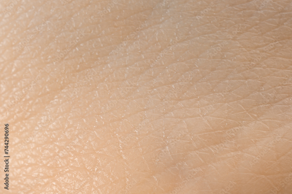 Fototapeta premium Texture of dry skin as background, macro view