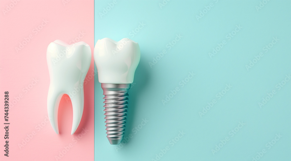 Dental implant with copy space for clarifications and benefits Dental implant with copy space for clarifications and benefits