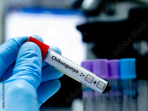 Blood sample of patient negative tested for chikungunya virus. photo