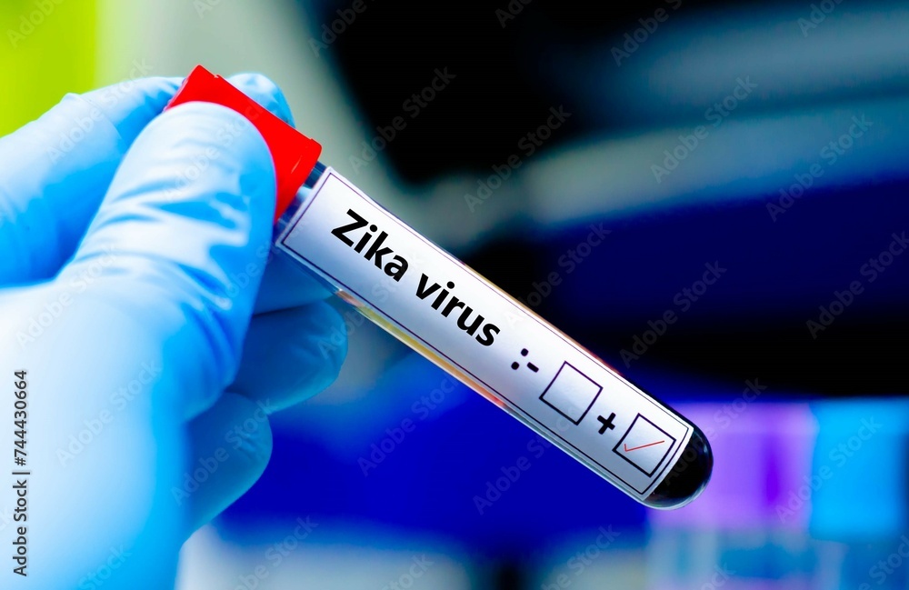 Obraz premium Blood sample of patient positive tested for zika virus.