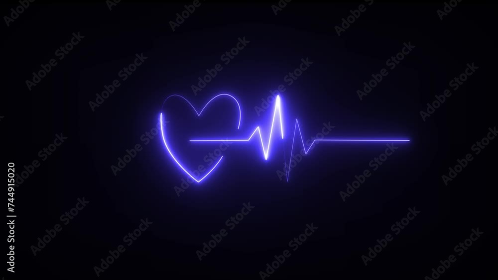 This is an electrical activity of heart. Which is demonstrated by electrocardiogram. This activity can show various type of disease of heart. This is an electrical activity of heart. Which is demonstrated by electrocardiogram. This activity can show various type of disease of heart.